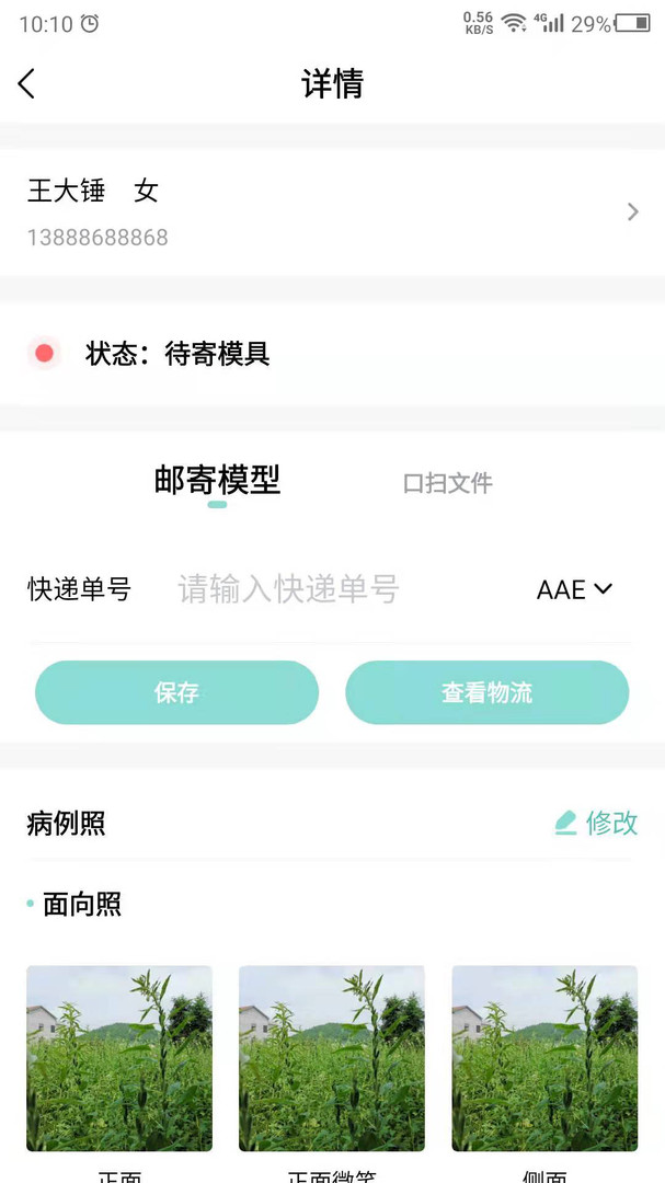 点讯牙套 截图1