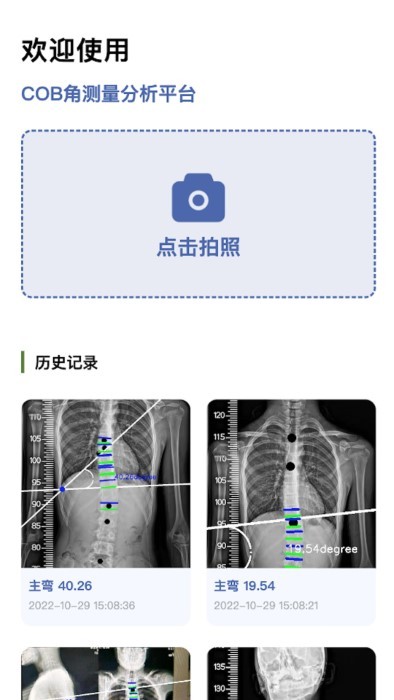 cobb角测量分析平台 截图2