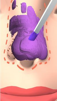 干净的鼻子游戏 截图2
