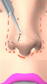 干净的鼻子游戏 截图3